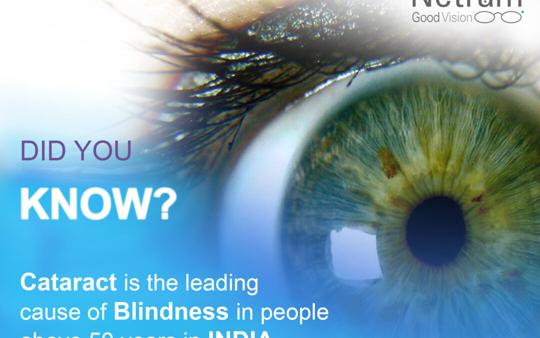 Cataract is the leading cause of blindness in people above 50 years
